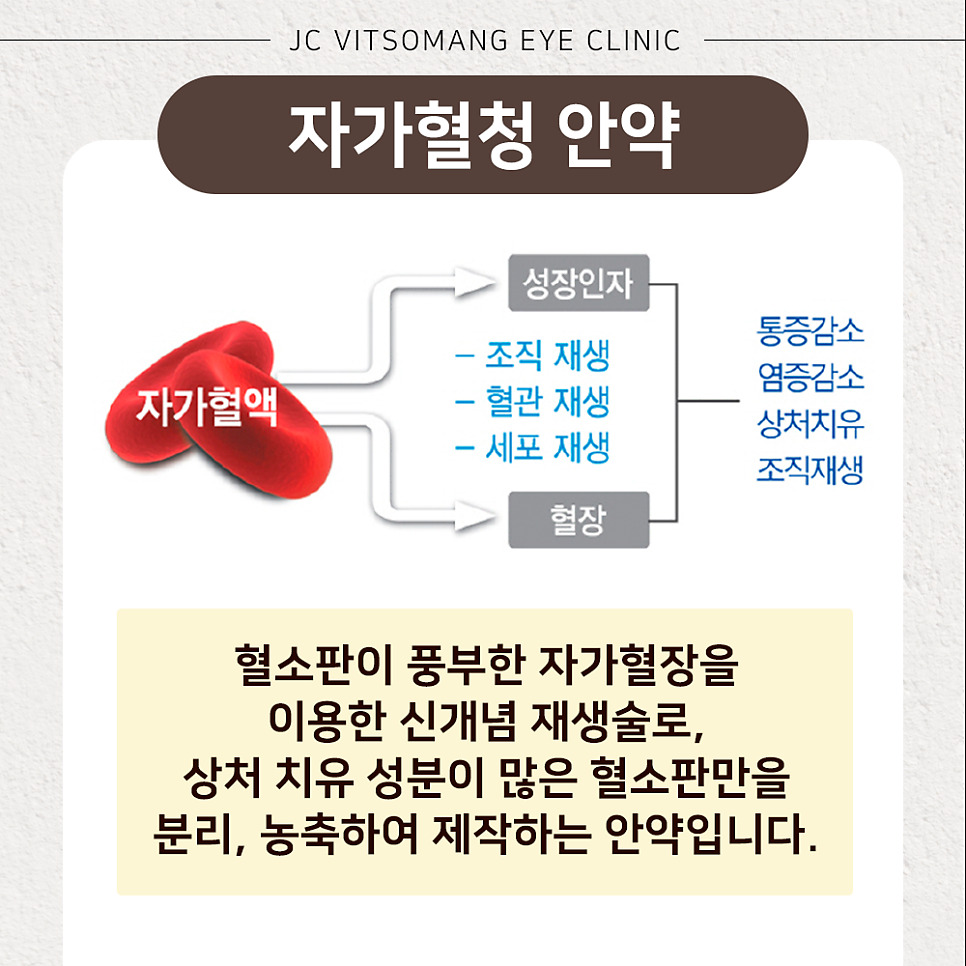 자가혈청 안약