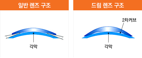 렌즈구조비교