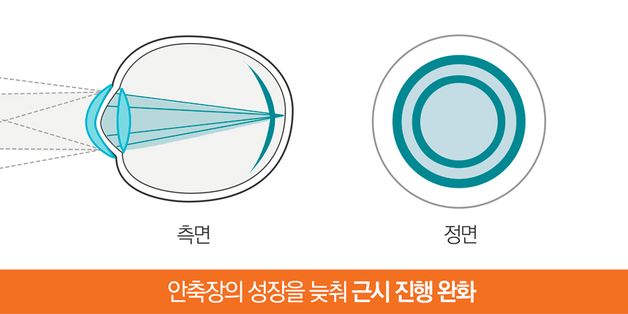 안축장길이도
