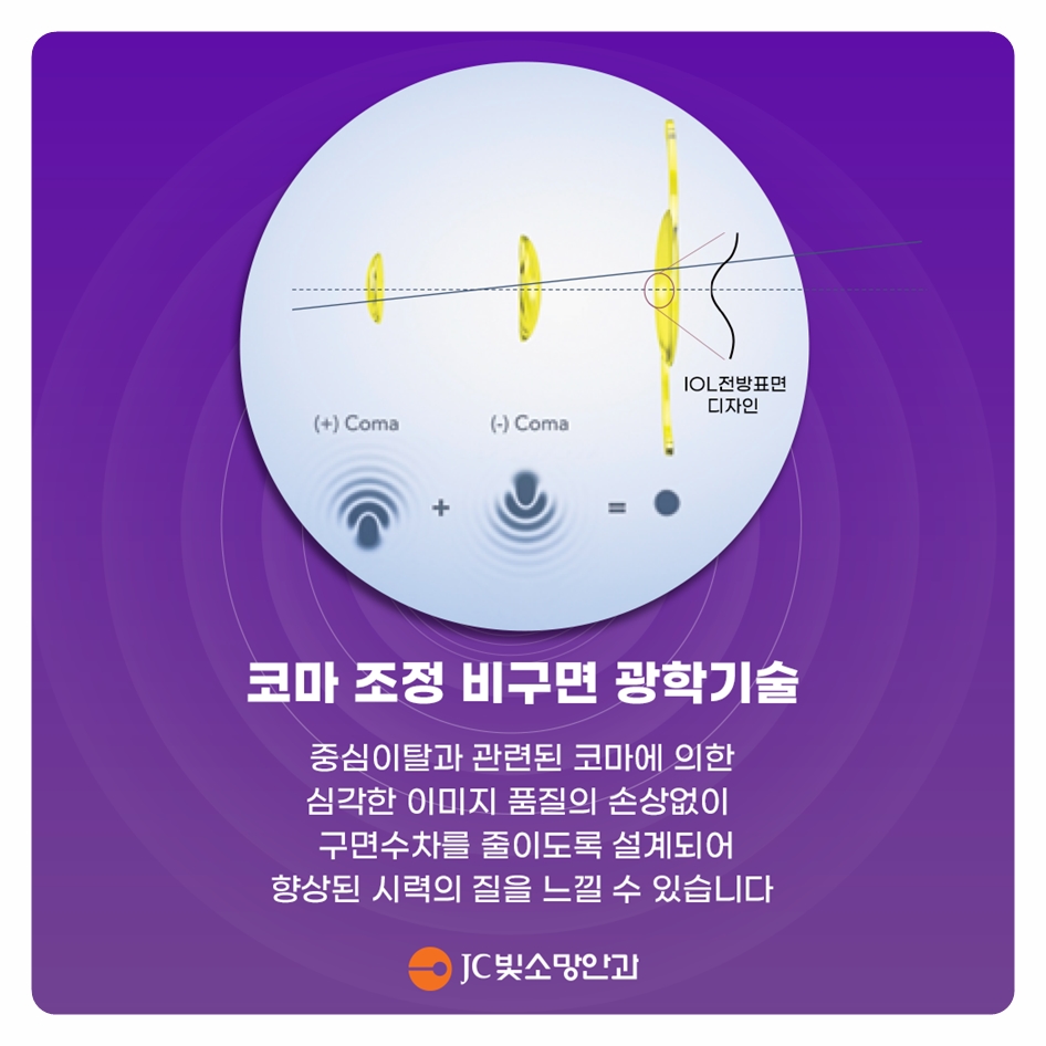 코마조정기술