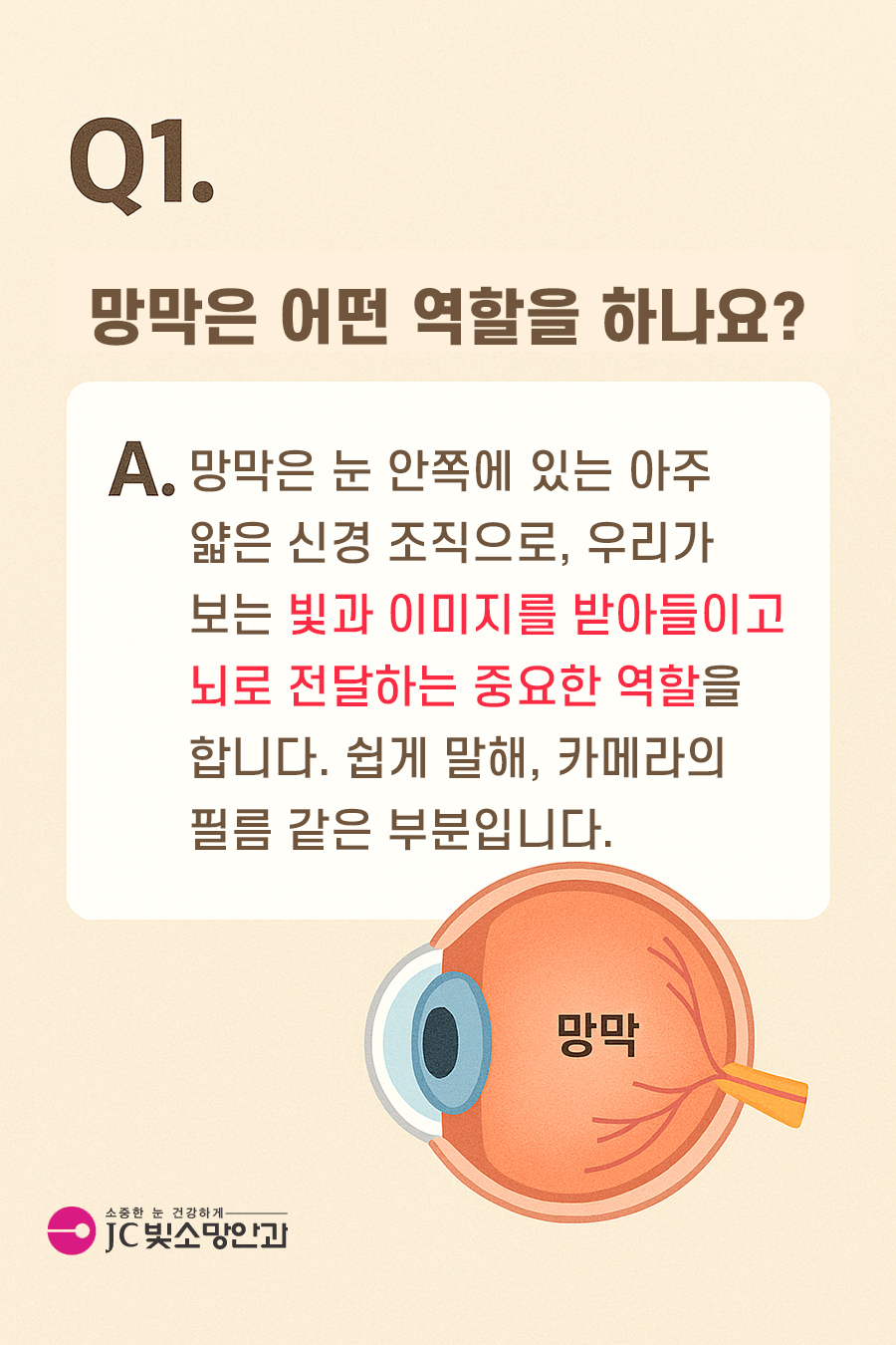 망막박리 재발과 재수술 판단, 여의도망막 진료 기준