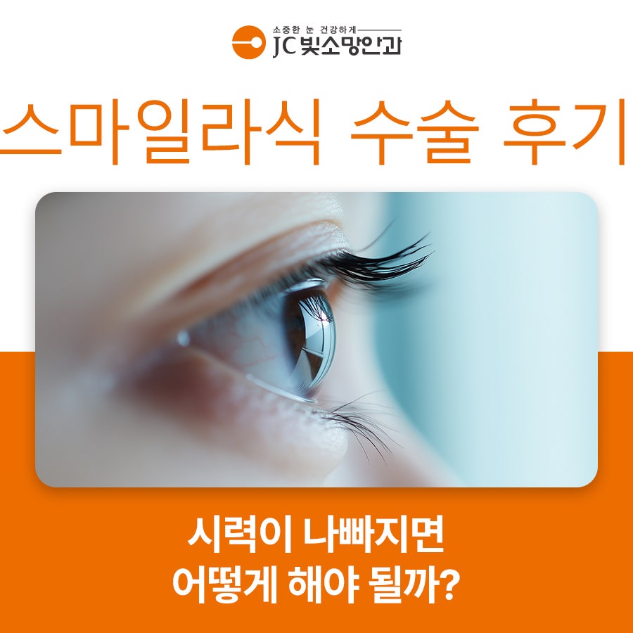 수술 후기 안내