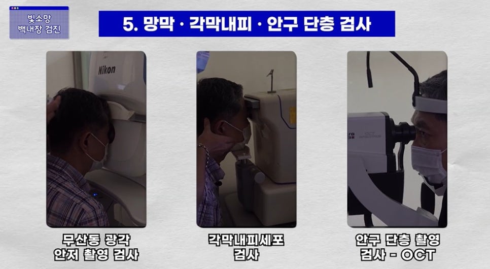 망막 단층촬영