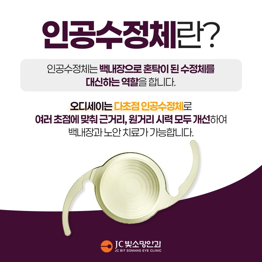 인공수정체설명