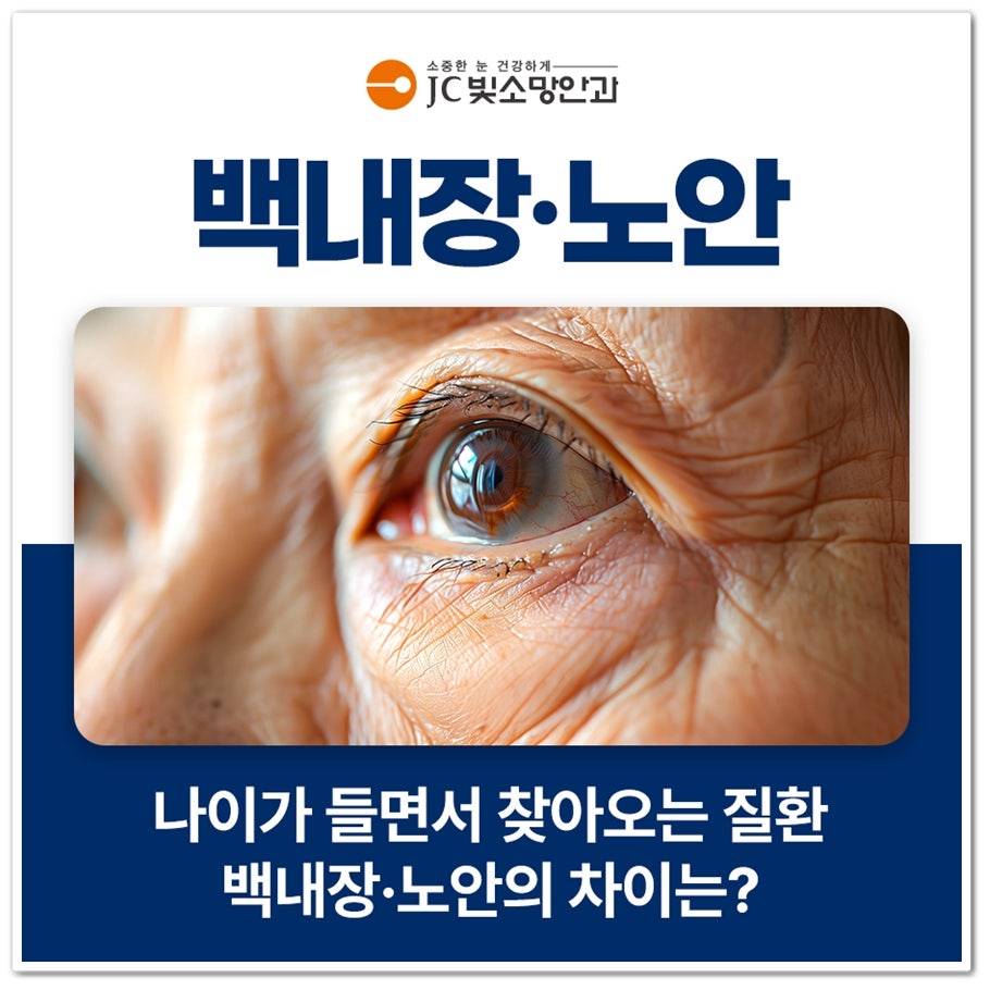 여의도 백내장 수술, 혼탁해진 수정체를 인공수정체로 바꾸는 원리