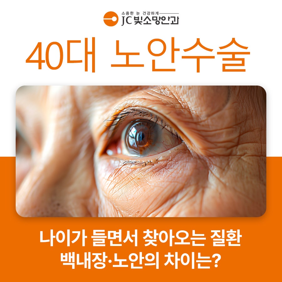 40대노안수술 표지