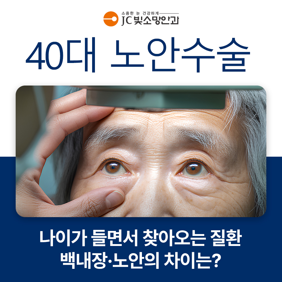 렌즈특징01