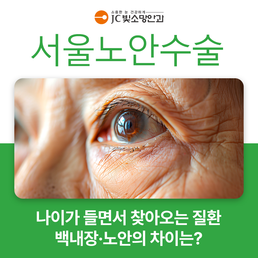 노안백내장안내