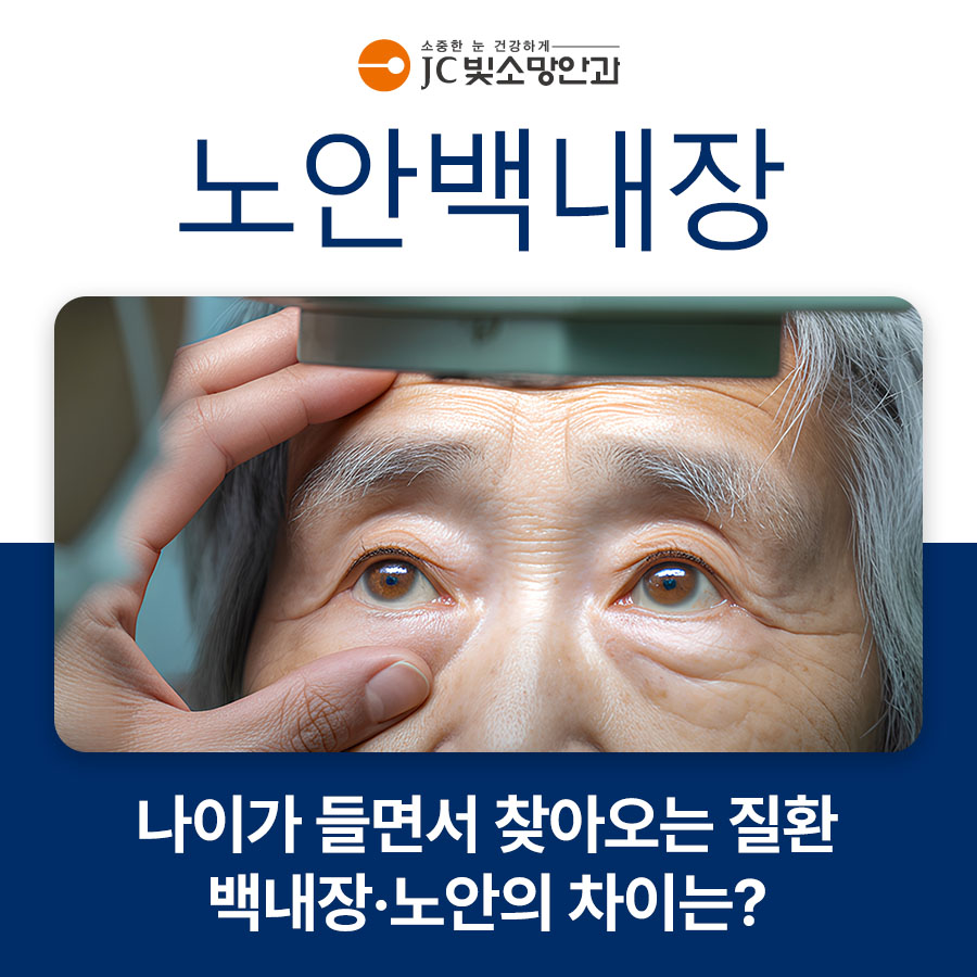 노안백내장