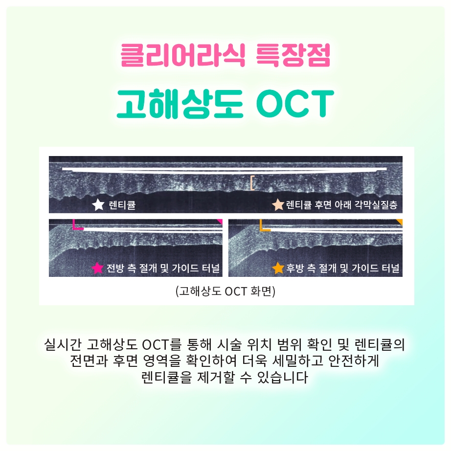 안압은 정상인데 여의도 녹내장? 정상안압녹내장 조기 발견이 중요한 이유