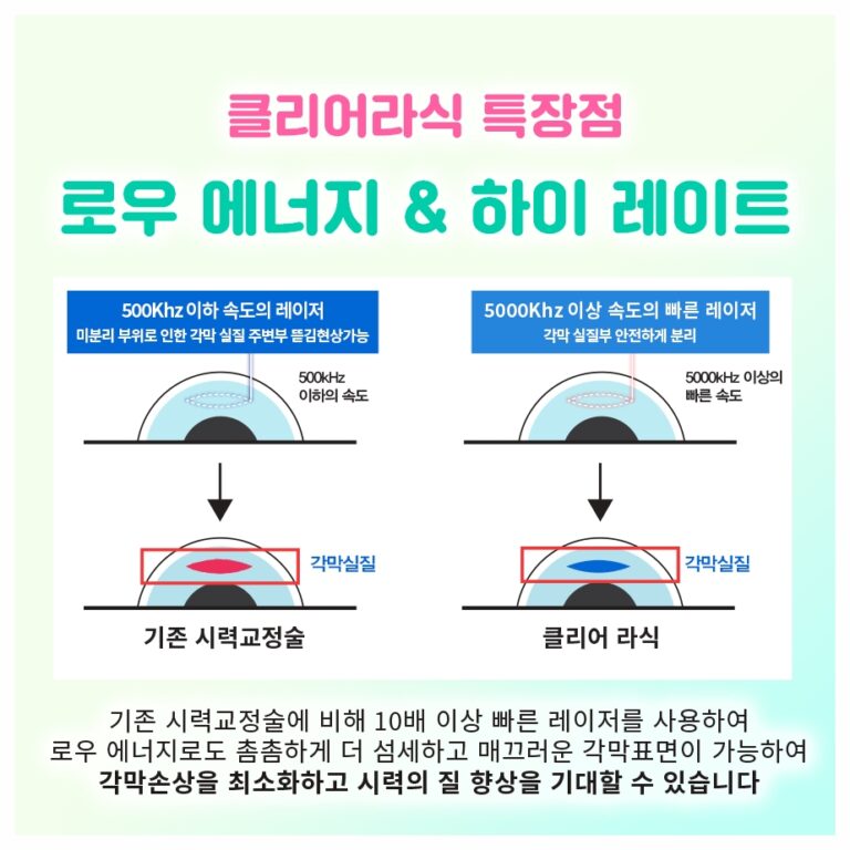 라식 후 도수가 남았을 때, 여의도라섹 등 표면레이저와 ICL 중 무엇을 고를까