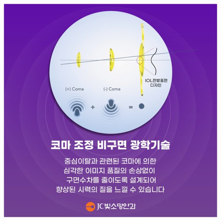 눈이 뻑뻑하고 시린데 안구건조증일까? 자가 체크 7가지