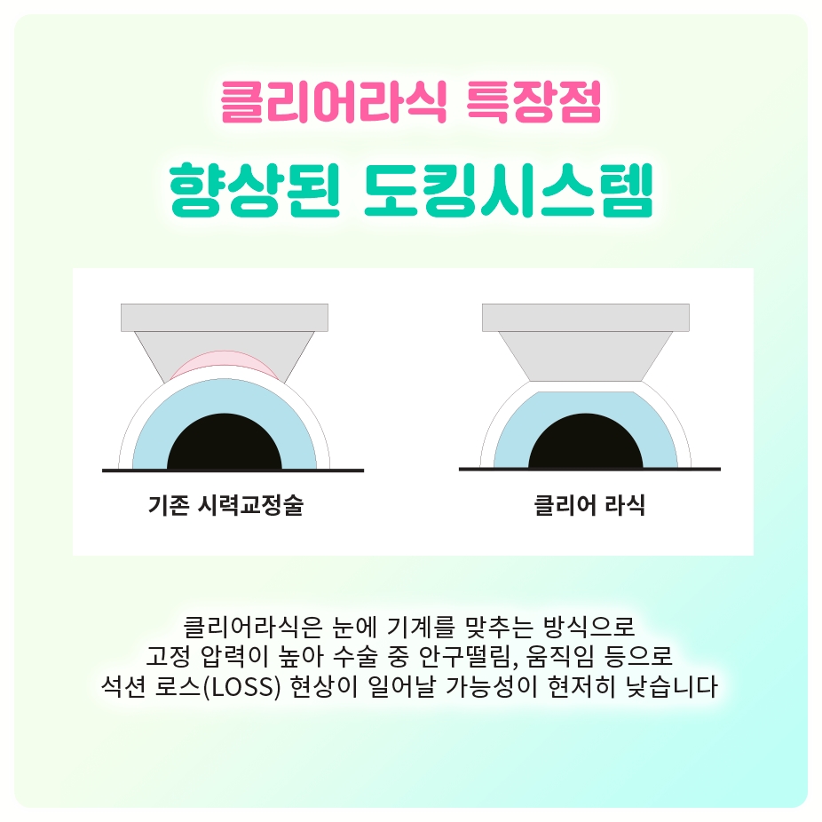 근거리·중간·원거리 중 내 생활에 맞는, 여의도시력교정 초점거리 정하는 법