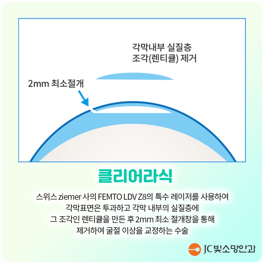 백내장수술 시기, 미루면 어떤 변화가 생기고 언제 결정해야 하나요