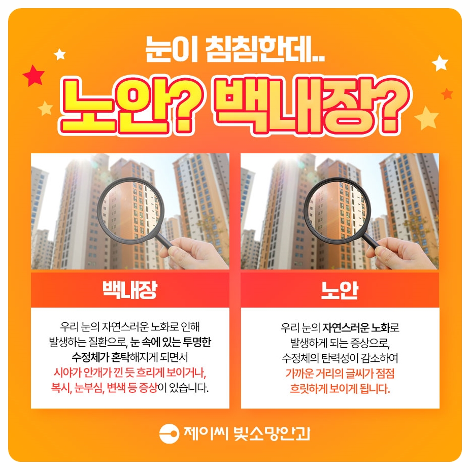 젊을 때 여의도라식 하면 노안은 어떻게 될까? 시력교정 시간표