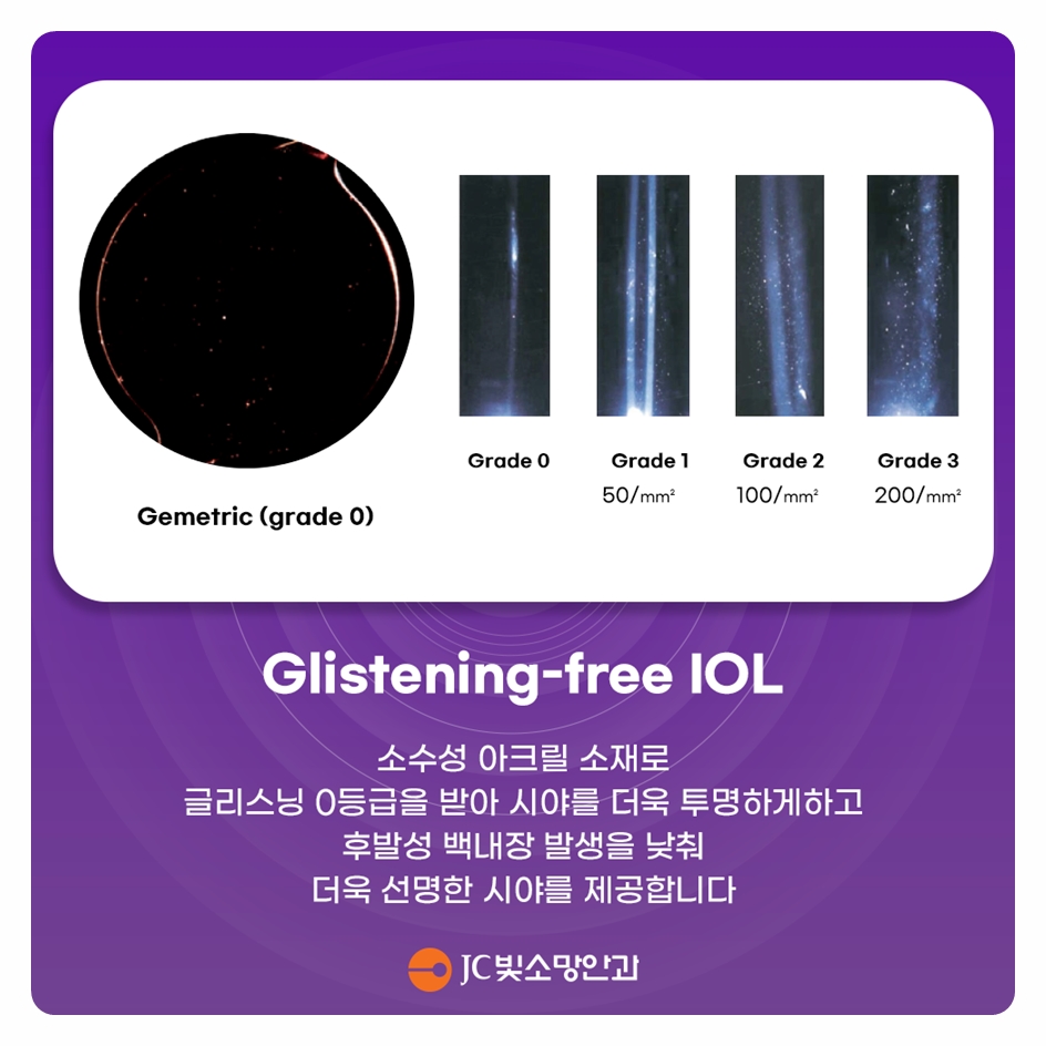 동공이 잘 안 커지거나 수정체가 흔들리는 까다로운 백내장수술, 다초점 렌즈도 될까