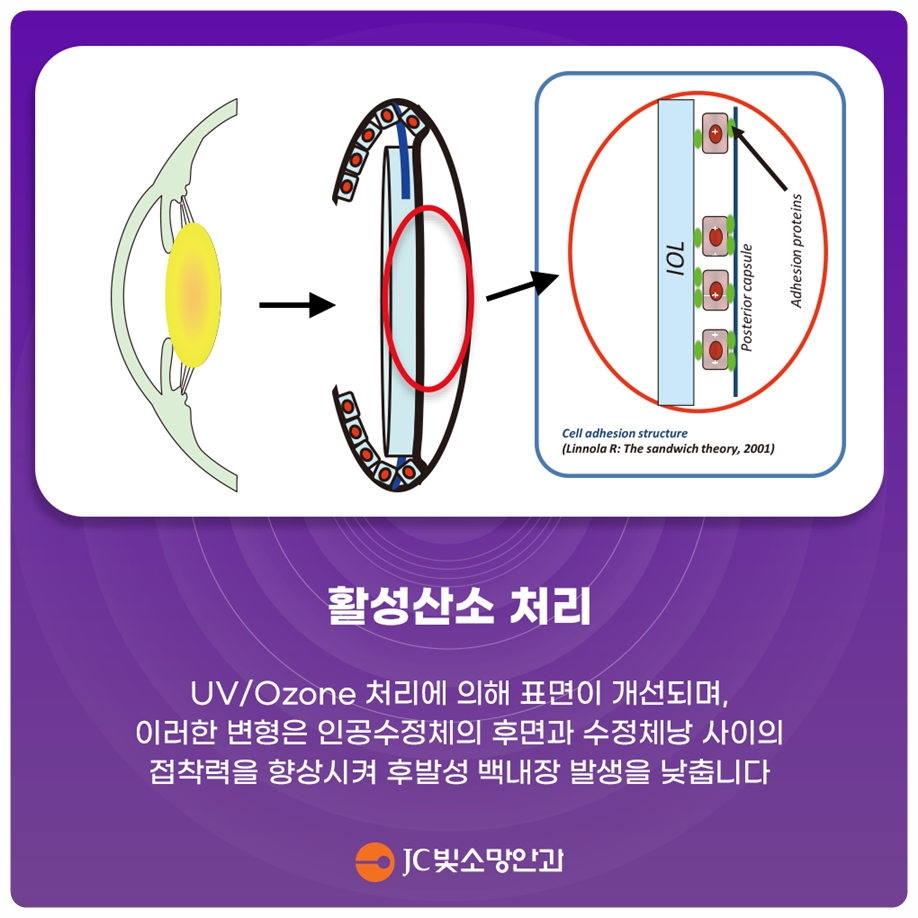 색이 바래고 누렇게 보인다면, 백내장수술 전 핵황화 색각 변화 확인법