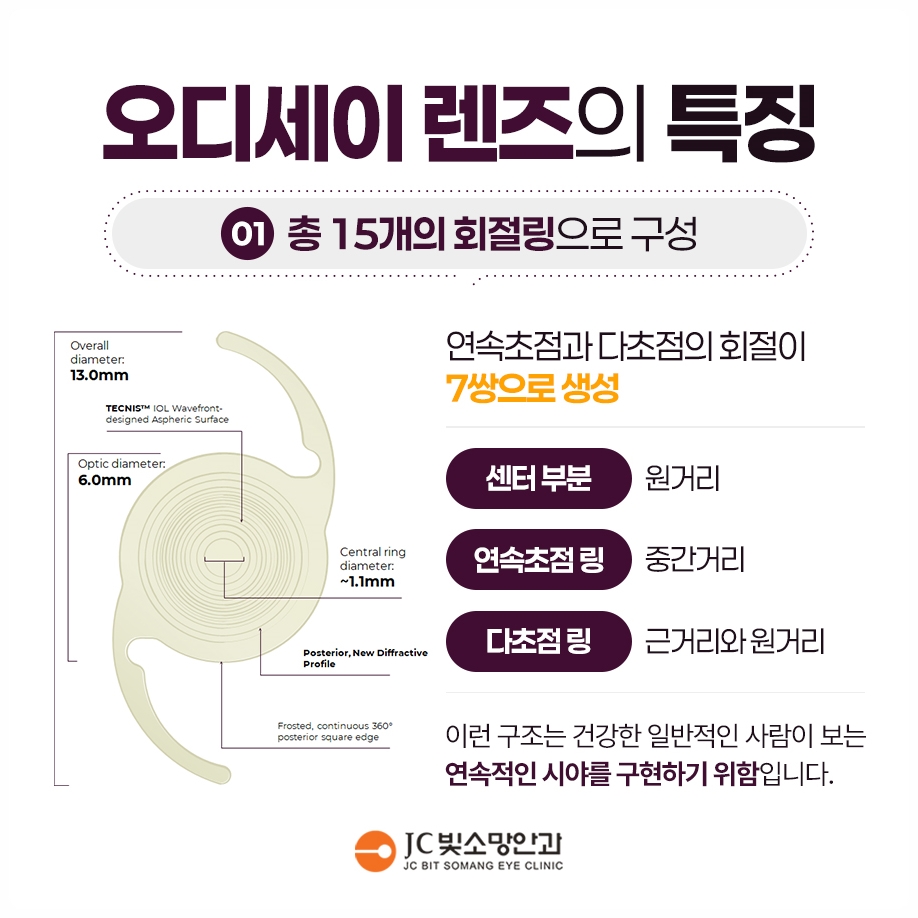 백내장 수술 후 안경, 새로 맞추는 시기와 도수 변화 이해