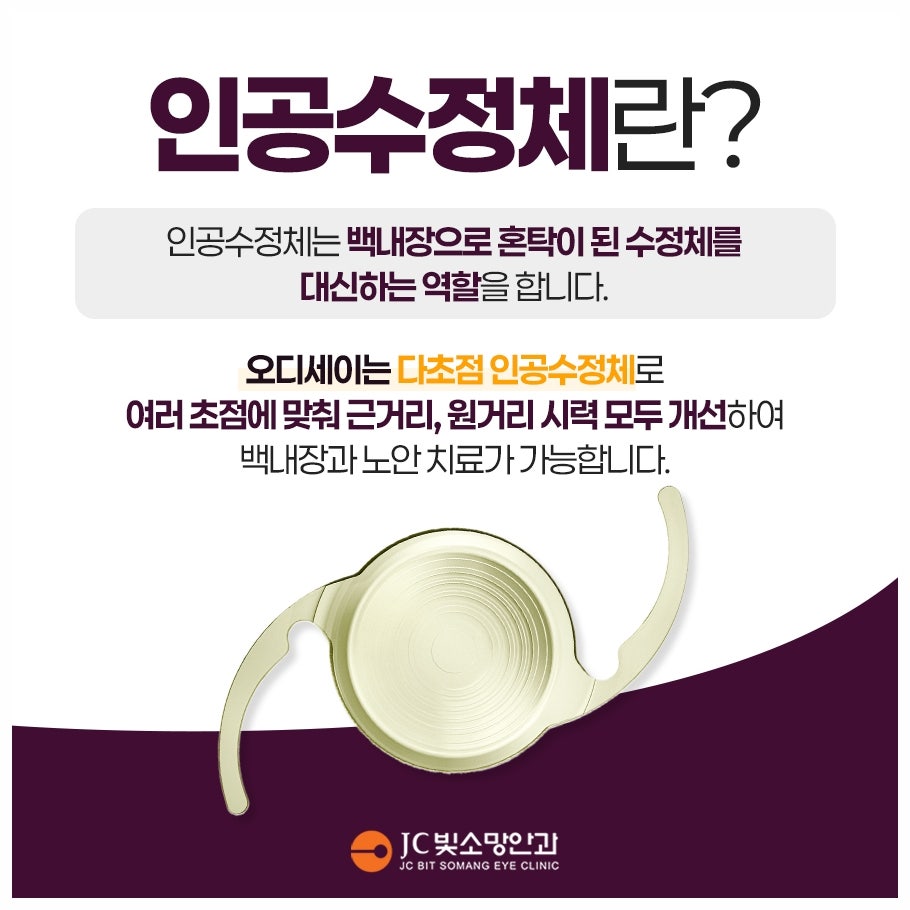 여의도 녹내장 안약, 평생 넣어야 할까 — 레이저(SLT)로 바꿀 수 있는 경우
