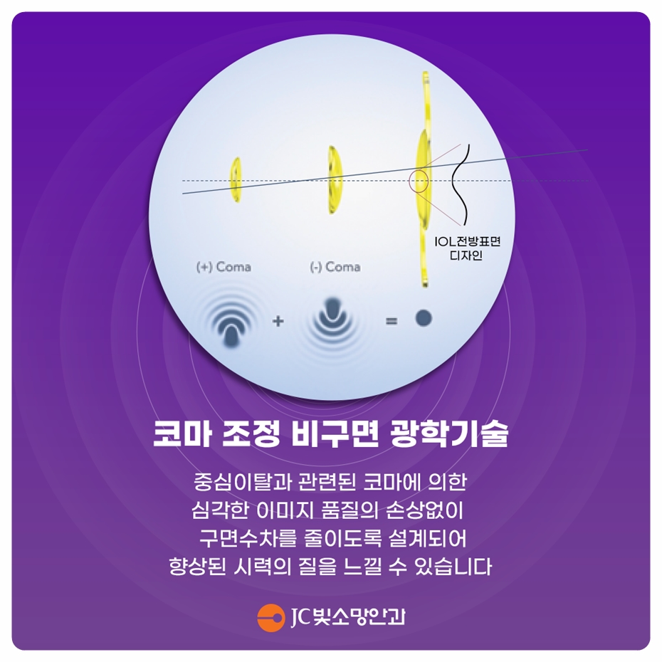 거짓비늘증후군과 소대 약화: 백내장 수술이 까다로워지는 이유와 보강링(CTR) 이해하기