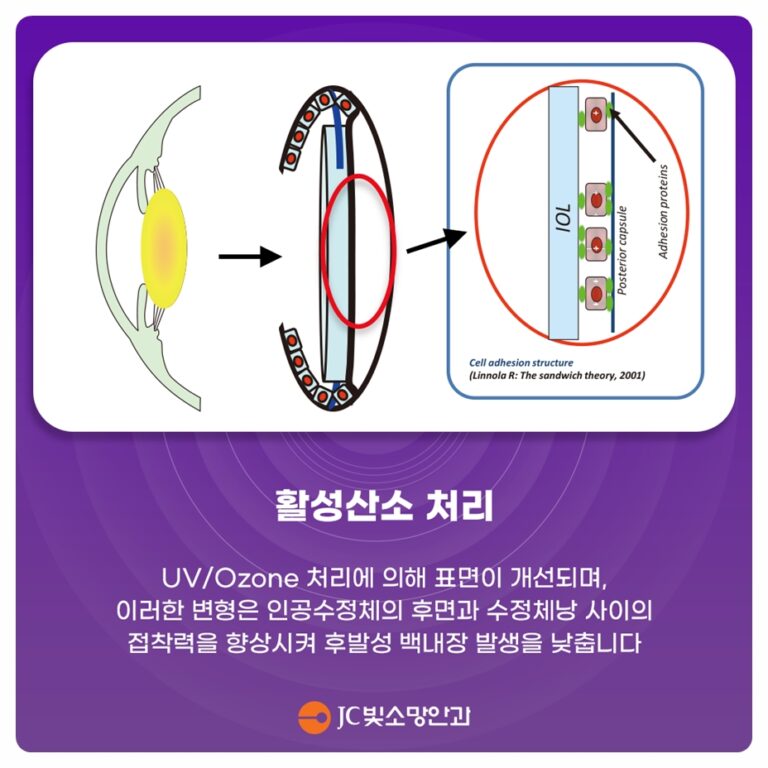자외선이 눈에 쌓이면 — 노안백내장과 황반, 선글라스 고르는 기준