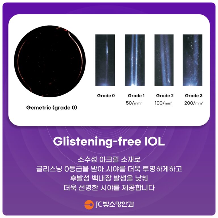 글자 윤곽이 번지고 겹쳐 보인다면, 여의도안과검진으로 확인하는 고도난시