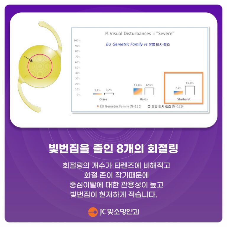 여의도소아안과가 권하는 야외활동 근시 예방 — 하루 두 시간의 차이