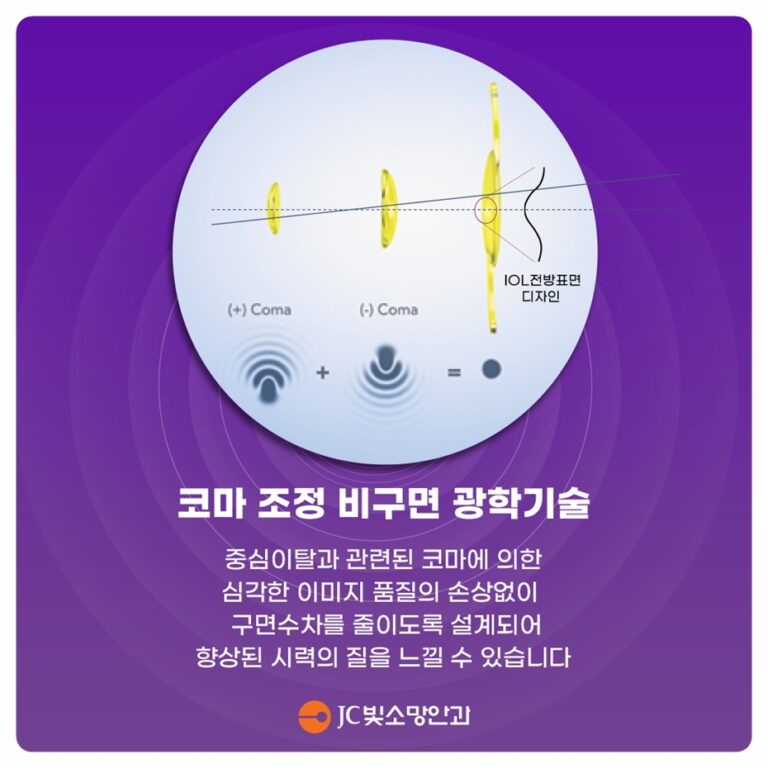 눈에 좋은 음식 정말 있을까, JC빛소망안과가 정리한 영양소 4가지
