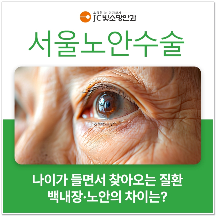 여의도라섹 수술 후 통증, 며칠이면 가라앉을까