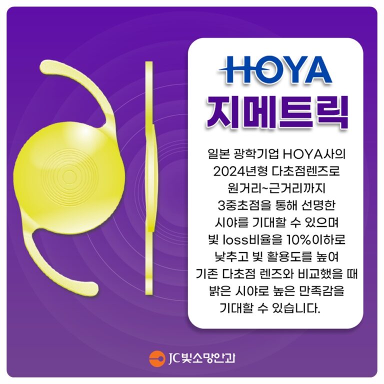다초점 인공수정체 빛번짐 안 가실 때, 노안백내장 렌즈 교체 판단법