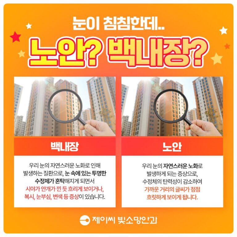 여의도 녹내장이 백내장과 함께 있다면, 동시 수술이 가능할까