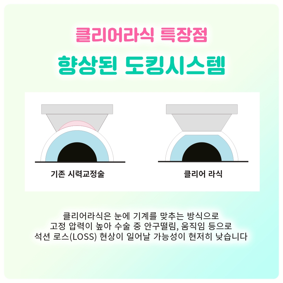 난시도 같이 잡는 토릭 ICL, 여의도시력교정 일반 ICL과 차이