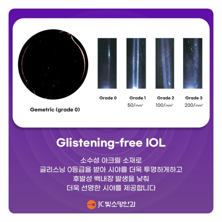 포도막염 병력으로 백내장 수술을 미루라고 했다면: 염증 조절과 수술 타이밍