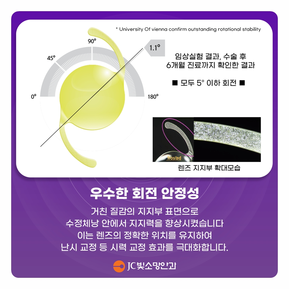 한쪽은 이미 했는데 반대쪽은? 여의도 백내장 수술 둘째 눈 인공수정체 선택 가이드