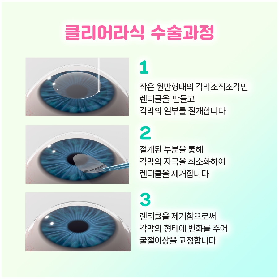 눈물이 줄줄 흐르는데 안구건조증이라고요? 눈물흘림의 진짜 이유