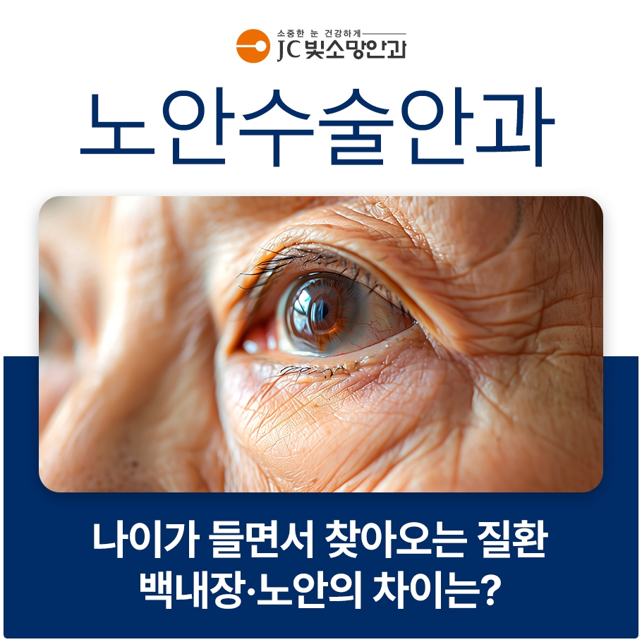 노안백내장 교정, 모노비전 라식 적응 실패 시 되돌리거나 재조정하는 방법