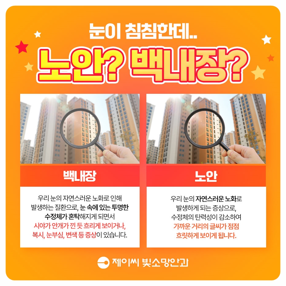 여의도라섹 수술 후 통증, 며칠이면 가라앉을까