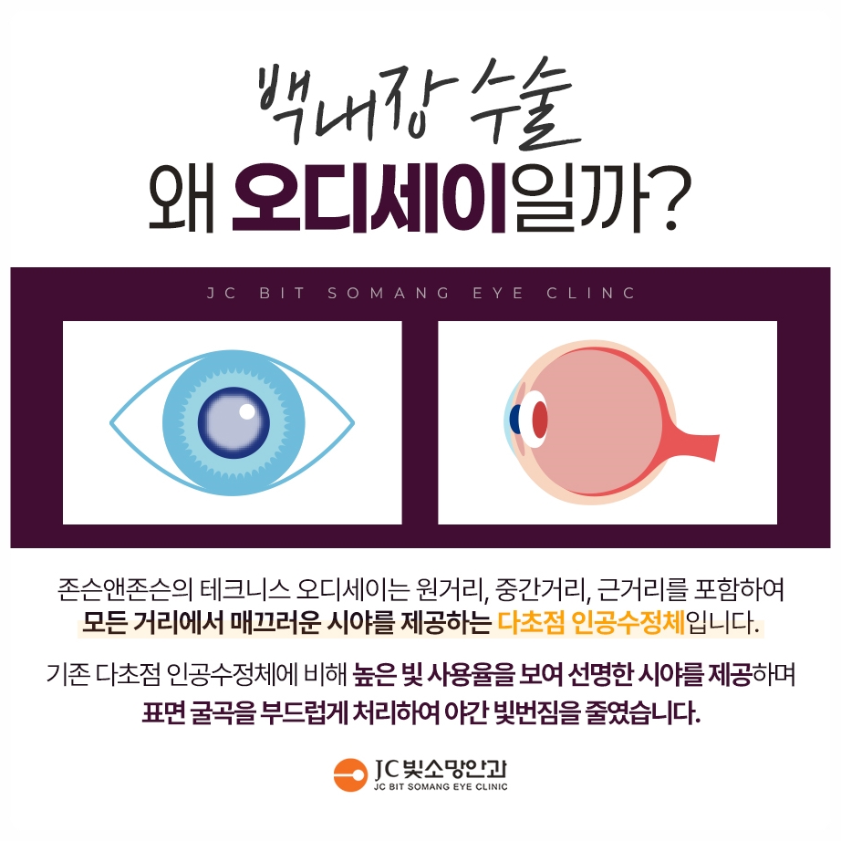 사물이 휘어 보일 때, 여의도망막 앞막(황반전막) 증상과 수술 시기