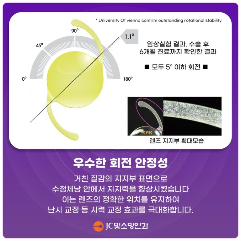 최근 1년 새 도수가 계속 변했다면, 여의도안과검진으로 보는 굴절 안정성