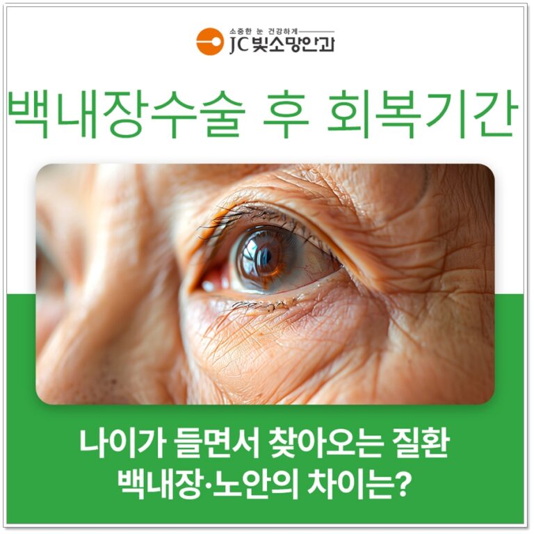 알레르기 결막염 안약, JC빛소망안과가 보는 항히스타민·비만세포안정제 선택 기준