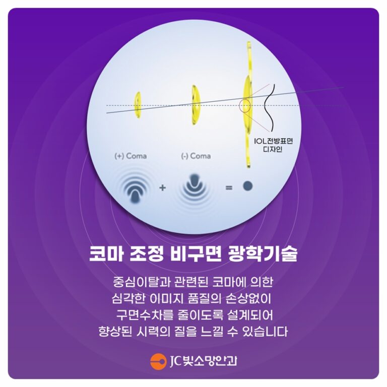 여의도시력교정 수술 전 검사 8가지, 라식·라섹 무엇을 왜 보나