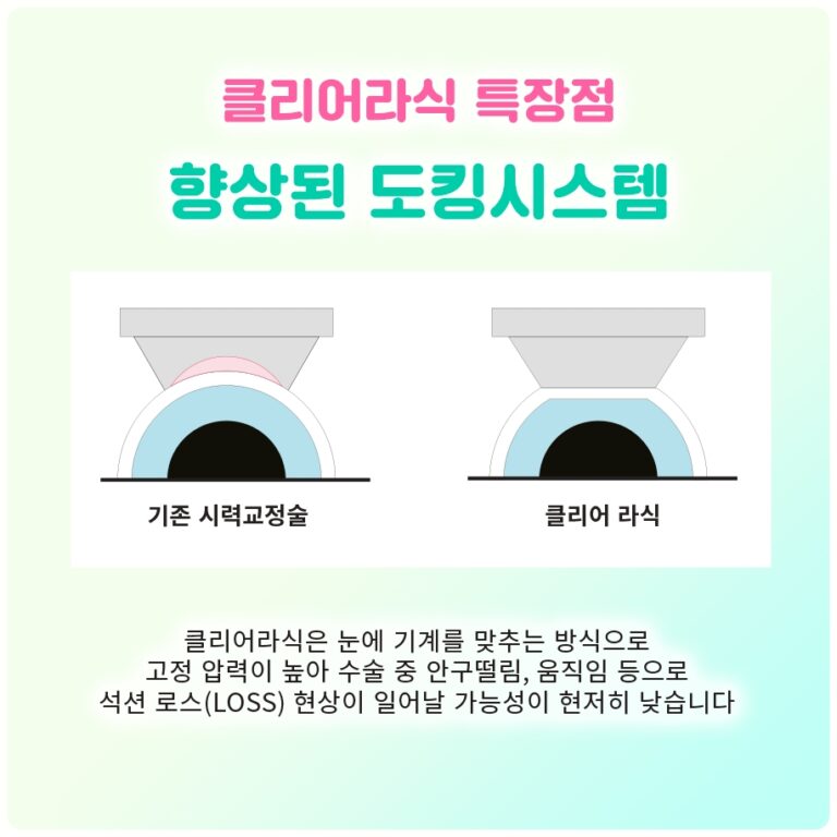 안구건조증이 심해 라식이 어렵다면, 건성안 정도를 재는 검사와 고려할 대안