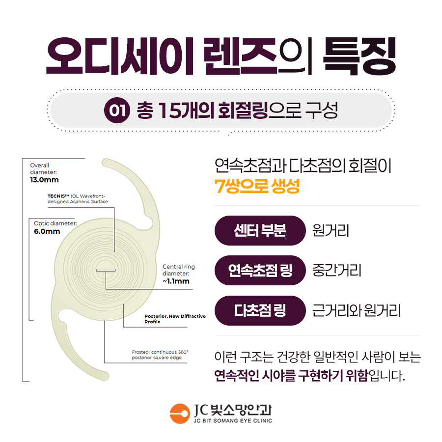 아이 양쪽 눈 시력차(부등시)가 크면 약시로 이어질까 — 여의도소아안과 진료 포인트