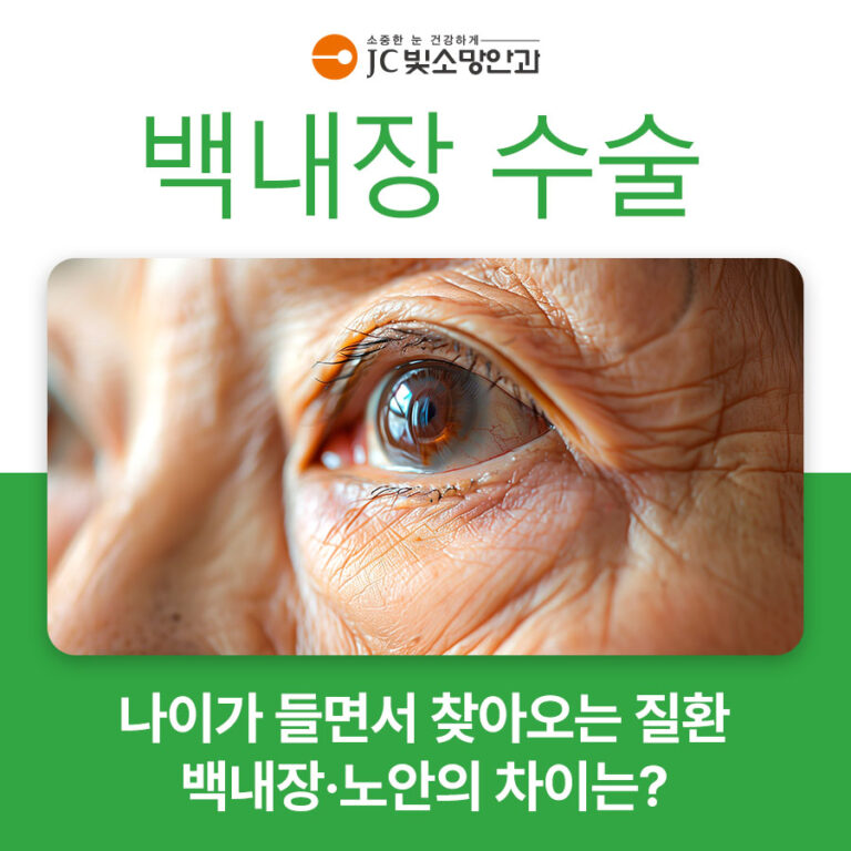안구건조증, 인공눈물로 부족할 때 마이봄샘 관리는 어떻게 할까