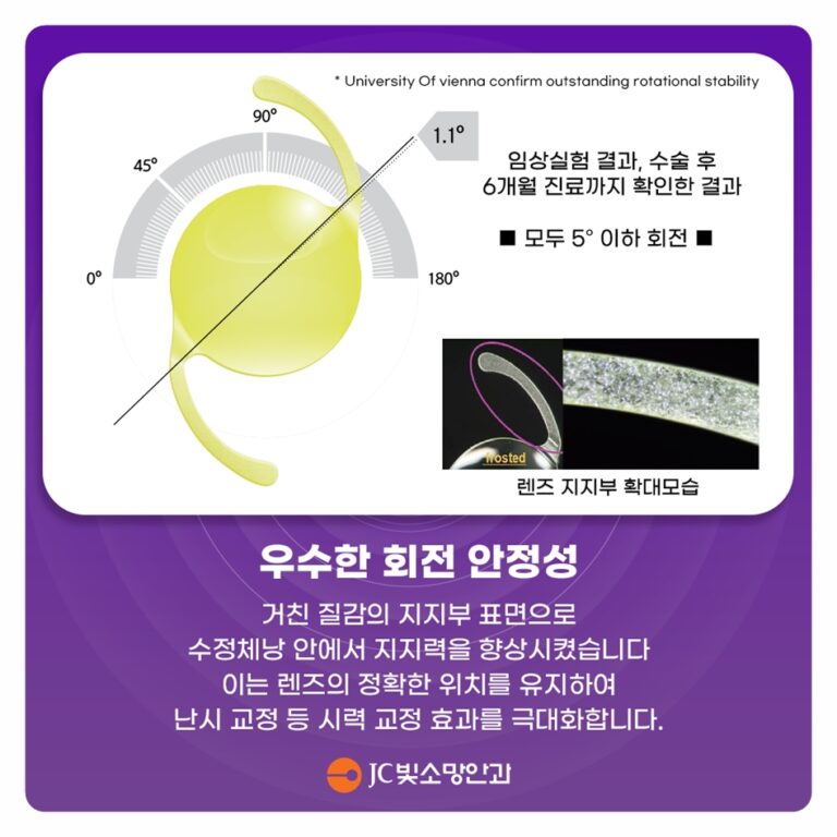 여의도망막 검사에서 구멍·찢어짐 발견, 레이저로 막을지 수술할지 갈림길
