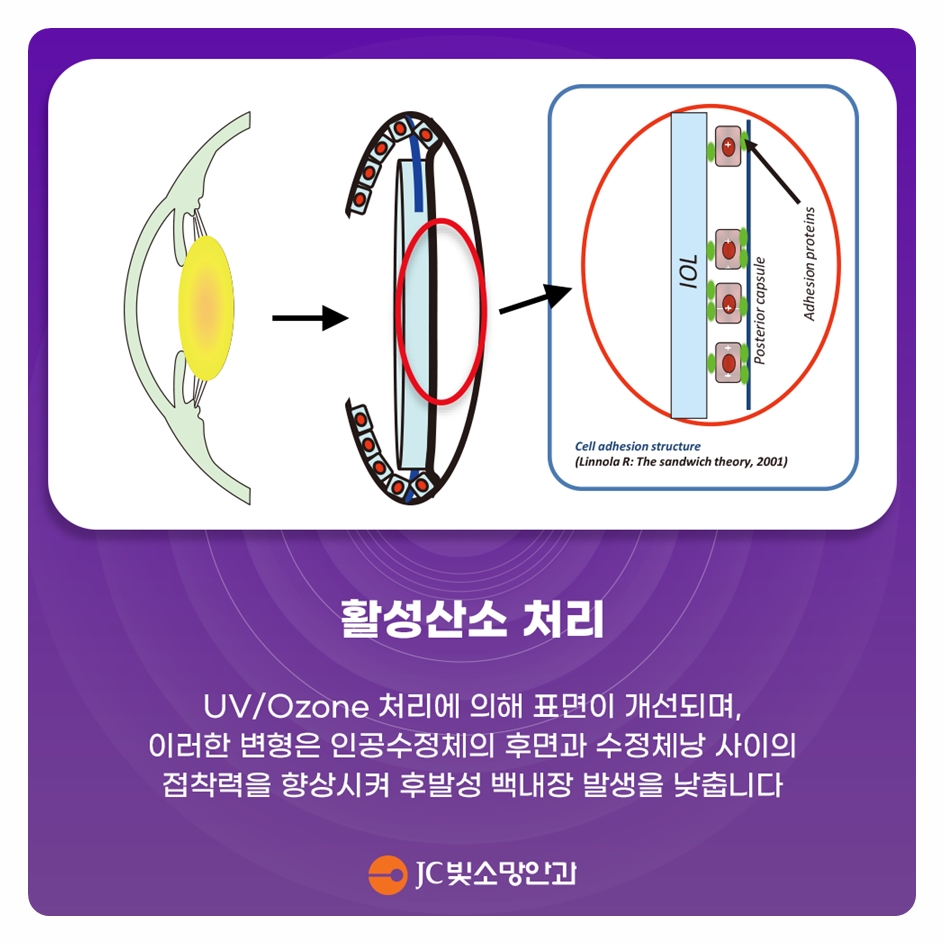 당뇨황반부종과 항VEGF 주사, 여의도망막 반복 치료가 필요한 이유