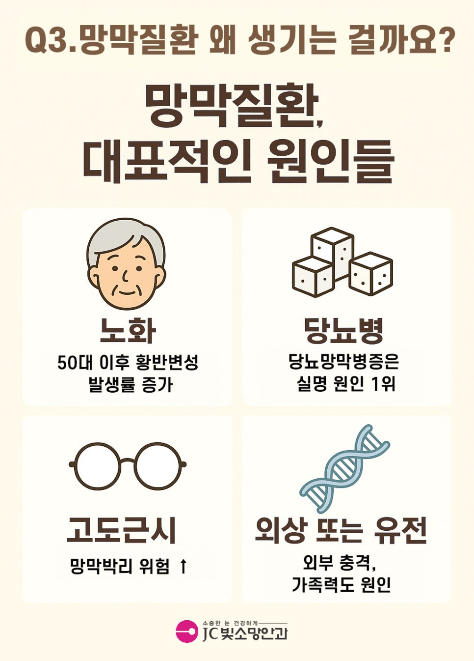 여의도시력교정 수술 전 검사 8가지, 라식·라섹 무엇을 왜 보나