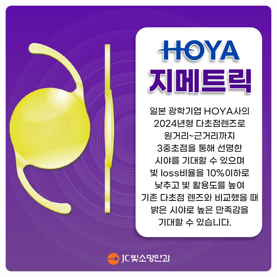 원추각막이면 여의도시력교정 어려울까 — 제외 대상 질환 총정리
