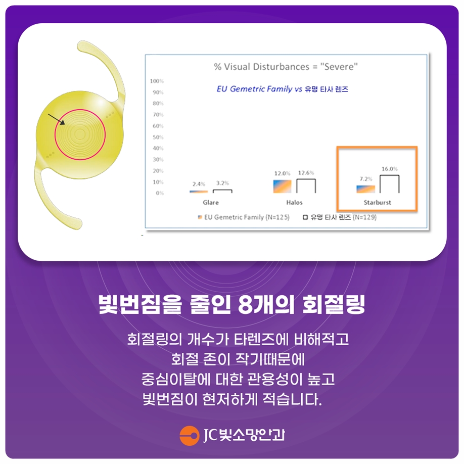여의도 녹내장 의심될 때, OCT와 시야검사 중 무엇부터 받아야 할까