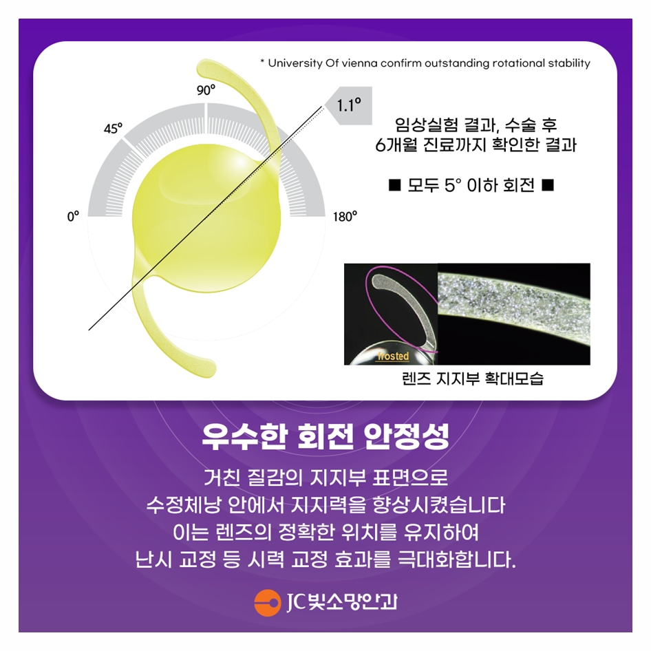 백내장수술 렌즈 선택 — 단초점 vs 다초점렌즈 차이 정리